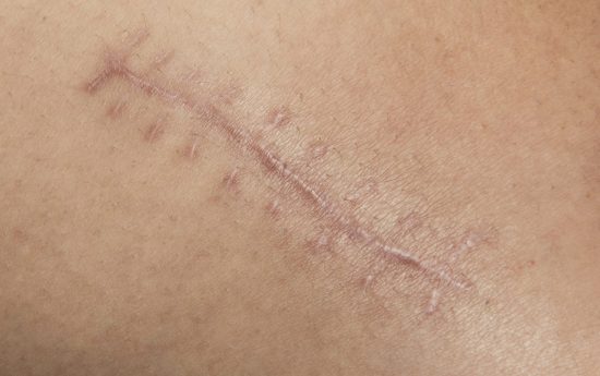 portal edu blogs - Conselleria d'Educació, Cultura i Esport